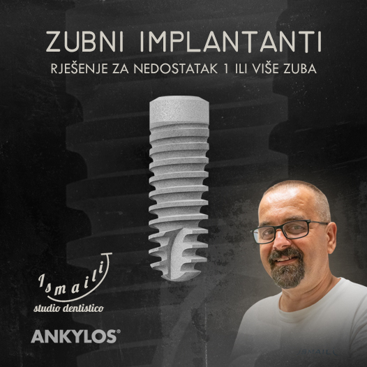 zubni implantanti
